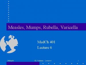 Measles Mumps Rubella Varicella Med Ch 401 Lecture