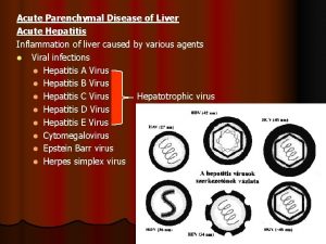 Acute Parenchymal Disease of Liver Acute Hepatitis Inflammation