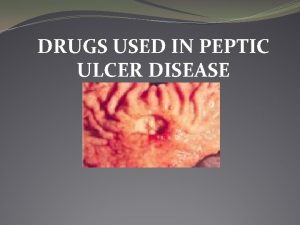 DRUGS USED IN PEPTIC ULCER DISEASE Pathophysiology Most