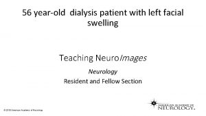 56 yearold dialysis patient with left facial swelling