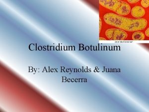 Clostridium Botulinum By Alex Reynolds Juana Becerra What