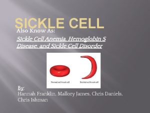 SICKLE CELL Also Know As Sickle Cell Anemia