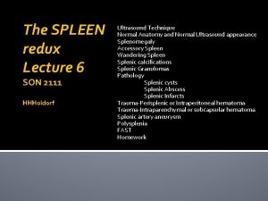 The SPLEEN redux Lecture 6 SON 2111 HHHoldorf