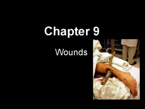 Chapter 9 Wounds Open Wounds A break in