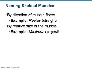 Naming Skeletal Muscles By direction of muscle fibers