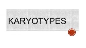 Too many chromosomes This is called NONDISJUNCTION Too