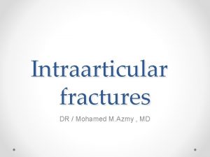 Intraarticular fractures DR Mohamed M Azmy MD The
