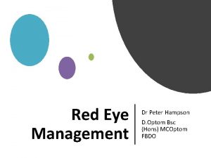 Red Eye Management Dr Peter Hampson D Optom