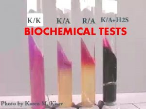 BIOCHEMICAL TESTS Biochemical tests are ordered to diagnose