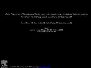 Fetal Diagnosis of Tetralogy of Fallot Major Aortopulmonary