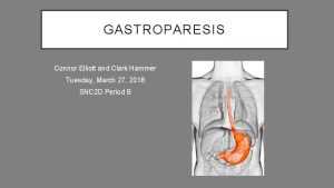 GASTROPARESIS Connor Elliott and Clark Hammer Tuesday March