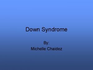 Down Syndrome By Michelle Chaidez John Langdon Down