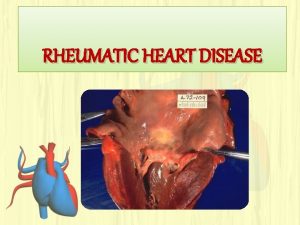 RHEUMATIC HEART DISEASE INTRODUCTION q RHD a most