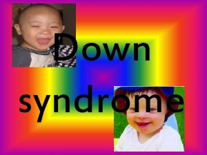 Down syndrome The risk of Down syndrome and