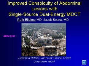 Improved Conspicuity of Abdominal Lesions with SingleSource DualEnergy