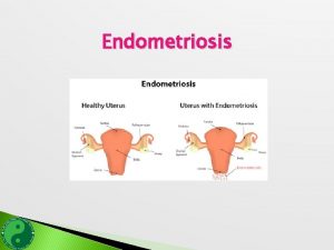 Endometriosis Endometriosis A disorder in which the tissue