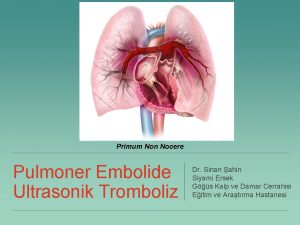 Primum Non Nocere Pulmoner Embolide Ultrasonik Tromboliz Dr