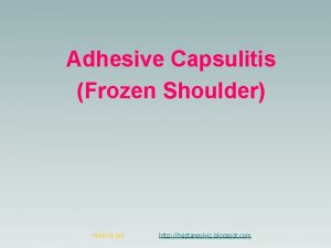 Adhesive Capsulitis Frozen Shoulder Medical ppt http hastaneciyiz