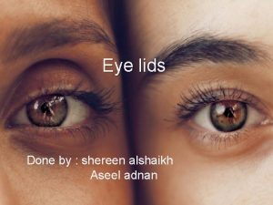 Eye lids Done by shereen alshaikh Aseel adnan