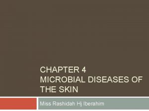 CHAPTER 4 MICROBIAL DISEASES OF THE SKIN Miss