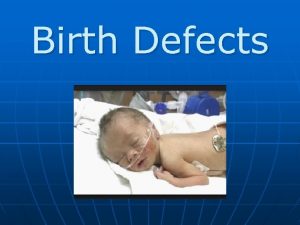 Birth Defects Cleft LipCleft Palate n n n