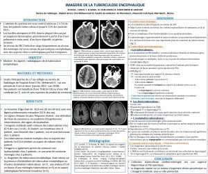 IMAGERIE DE LA TUBERCULOSE ENCEPHALIQUE M OUHA C