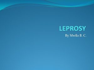 LEPROSY By Mwila B C DEFINITION Leprosy is