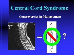 Central Cord Syndrome Controversies in Management Central cord
