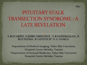 NR 12 PITUITARY STALK TRANSECTION SYNDROME A LATE