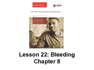 Lesson 22 Bleeding Chapter 8 Introduction Bleeding is