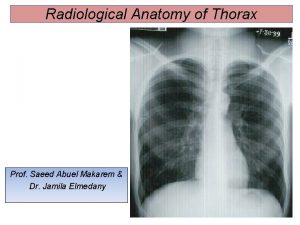 Radiological Anatomy of Thorax Prof Saeed Abuel Makarem