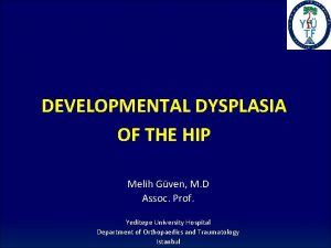 DEVELOPMENTAL DYSPLASIA OF THE HIP Melih Gven M