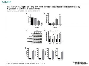 Knockdown of Long NonCoding RNA RP 11 445