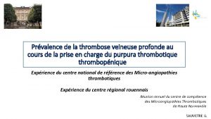 Prvalence de la thrombose veineuse profonde au cours