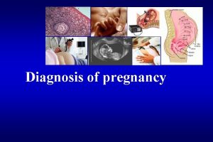 Diagnosis of pregnancy diagnosis of early pregnancy 1