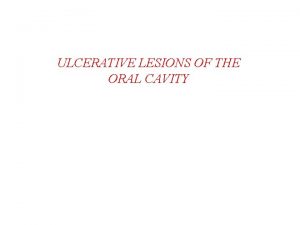 ULCERATIVE LESIONS OF THE ORAL CAVITY Macule flat