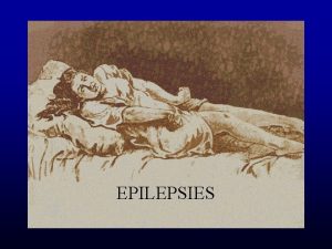 EPILEPSIES Dfinitions Epilambanein Prendre par surprise Crise pileptique