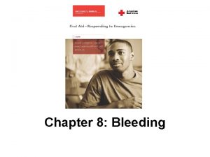 Chapter 8 Bleeding Introduction Bleeding is the escape