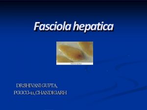 Fasciola hepatica DR SHIVANI GUPTA PGGCG11 CHANDIGARH Classification