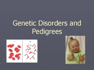 Genetic Disorders and Pedigrees Overview So far weve