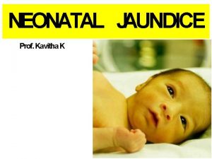 NEONATAL JAUNDICE Prof Kavitha K Objectives Define neonatal