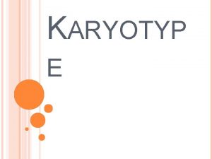 KARYOTYP E KARYOTYPE Picture of chromosomes from Prophase