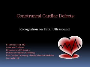 Conotruncal Cardiac Defects Recognition on Fetal Ultrasound R