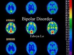 Bipolar Disorder Edwyn Lo What is Bipolar Disorder