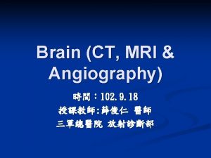 1 Frontal bone 2 Parietal bone 3 Dura