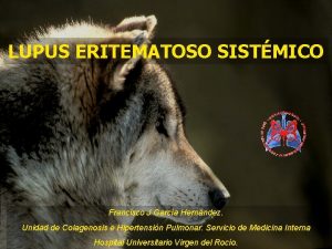 LUPUS ERITEMATOSO SISTMICO Francisco J Garca Hernndez Unidad