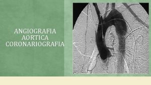 ANGIOGRAFIA AORTICA CORONARIOGRAFIA QUE ES La angiografa artica