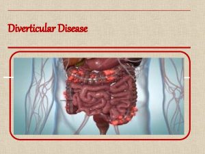 Diverticular Disease Introduction Colonic diverticula are aquired false