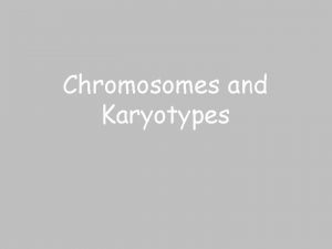 Chromosomes and Karyotypes Chromosome Structure Metaphase Chromosome Histone