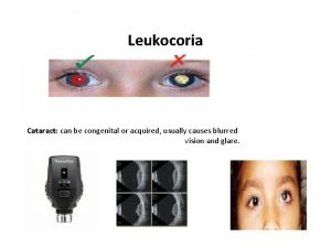 Leukocoria Cataract can be congenital or acquired usually